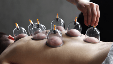 Image for Cupping 30 minute session