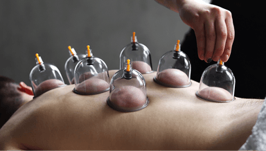 Image for Cupping 45 minute session